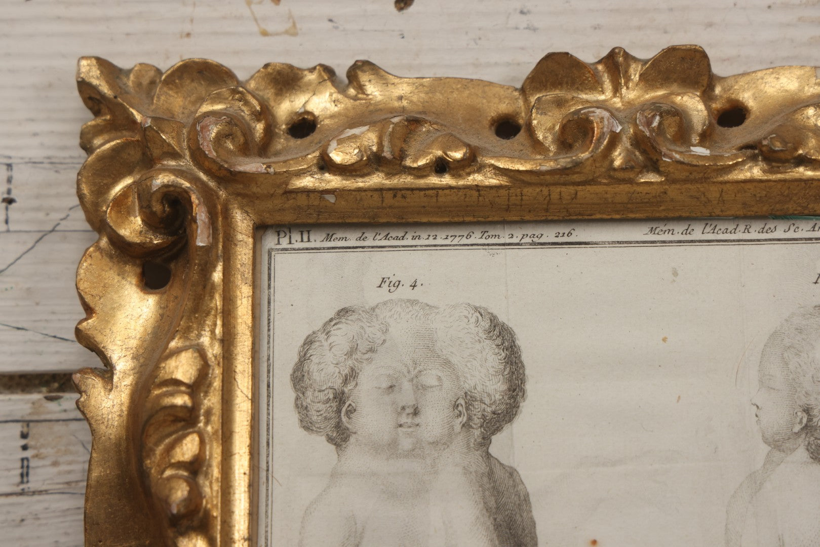 Lot 015 - Antique Anatomical Engraving Of Conjoined Twins, From Mémoires De L'Académie Royale Des Sciences, Paris, 1776, After Drawings By Fossier (Del.) And Engraved By Y. Le G. (Sc.), French Medical Illustration, Framed, 9-5/8" x 11-5/8"