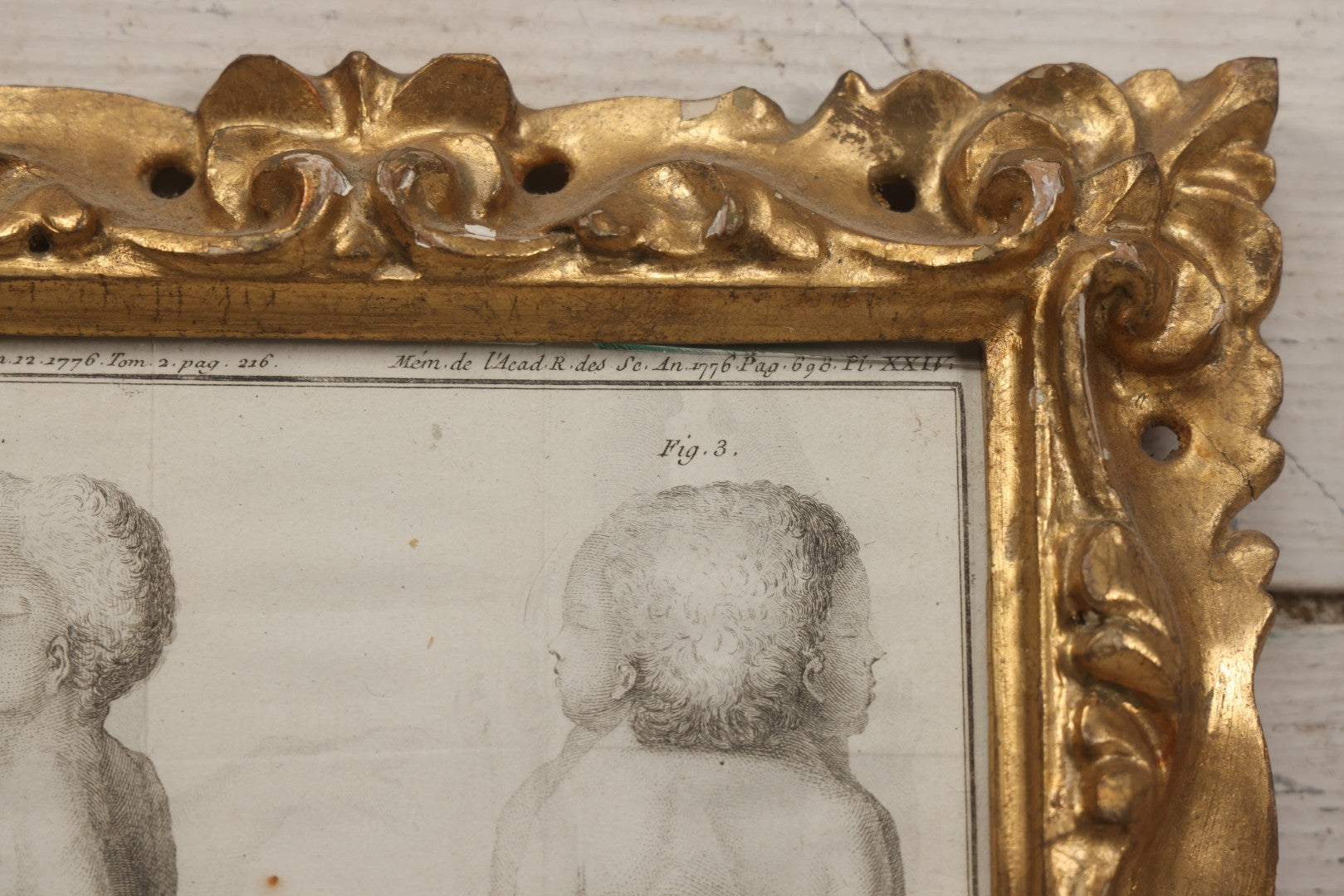 Lot 015 - Antique Anatomical Engraving Of Conjoined Twins, From Mémoires De L'Académie Royale Des Sciences, Paris, 1776, After Drawings By Fossier (Del.) And Engraved By Y. Le G. (Sc.), French Medical Illustration, Framed, 9-5/8" x 11-5/8"