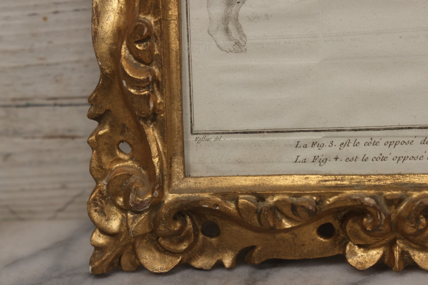 Lot 015 - Antique Anatomical Engraving Of Conjoined Twins, From Mémoires De L'Académie Royale Des Sciences, Paris, 1776, After Drawings By Fossier (Del.) And Engraved By Y. Le G. (Sc.), French Medical Illustration, Framed, 9-5/8" x 11-5/8"