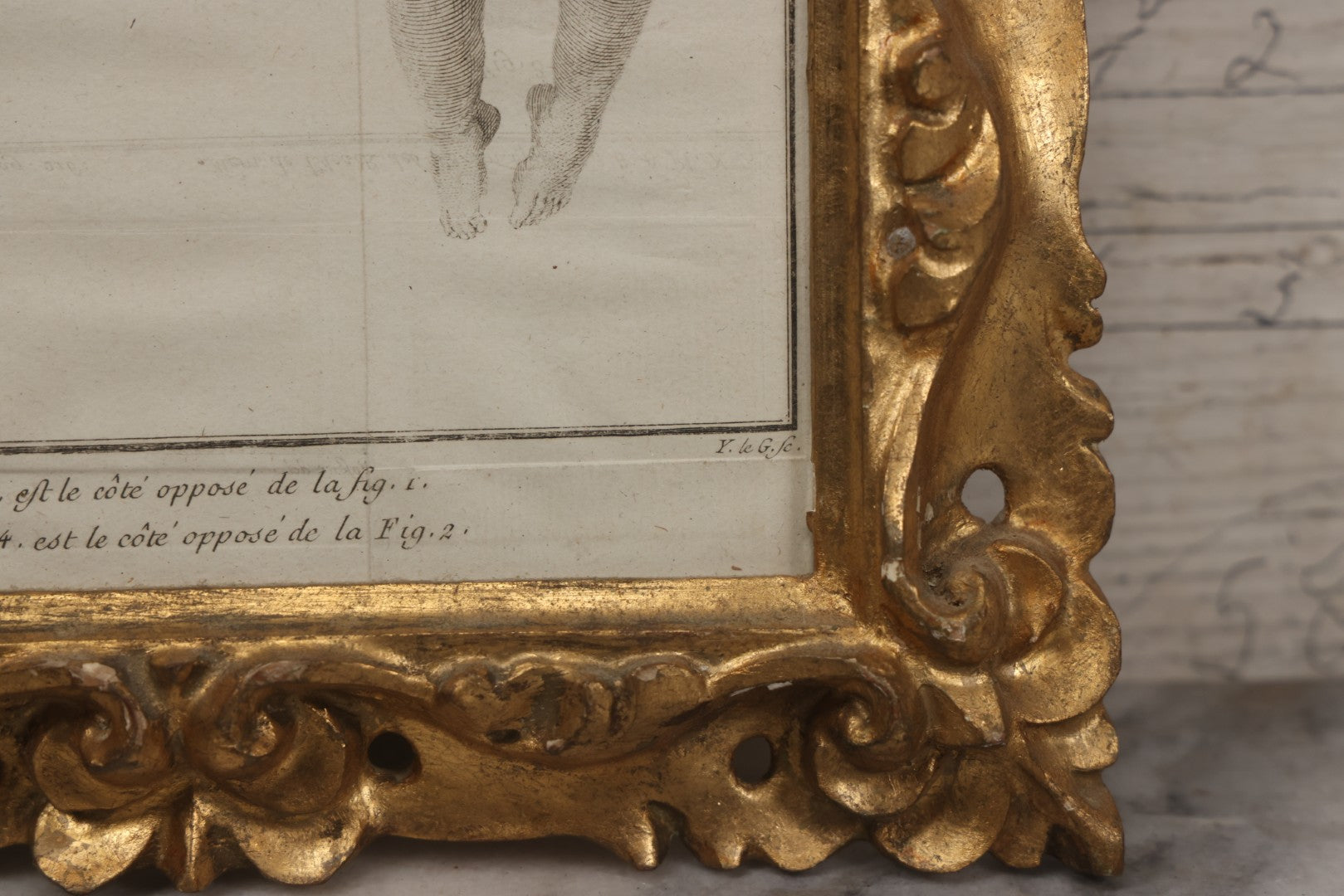 Lot 015 - Antique Anatomical Engraving Of Conjoined Twins, From Mémoires De L'Académie Royale Des Sciences, Paris, 1776, After Drawings By Fossier (Del.) And Engraved By Y. Le G. (Sc.), French Medical Illustration, Framed, 9-5/8" x 11-5/8"
