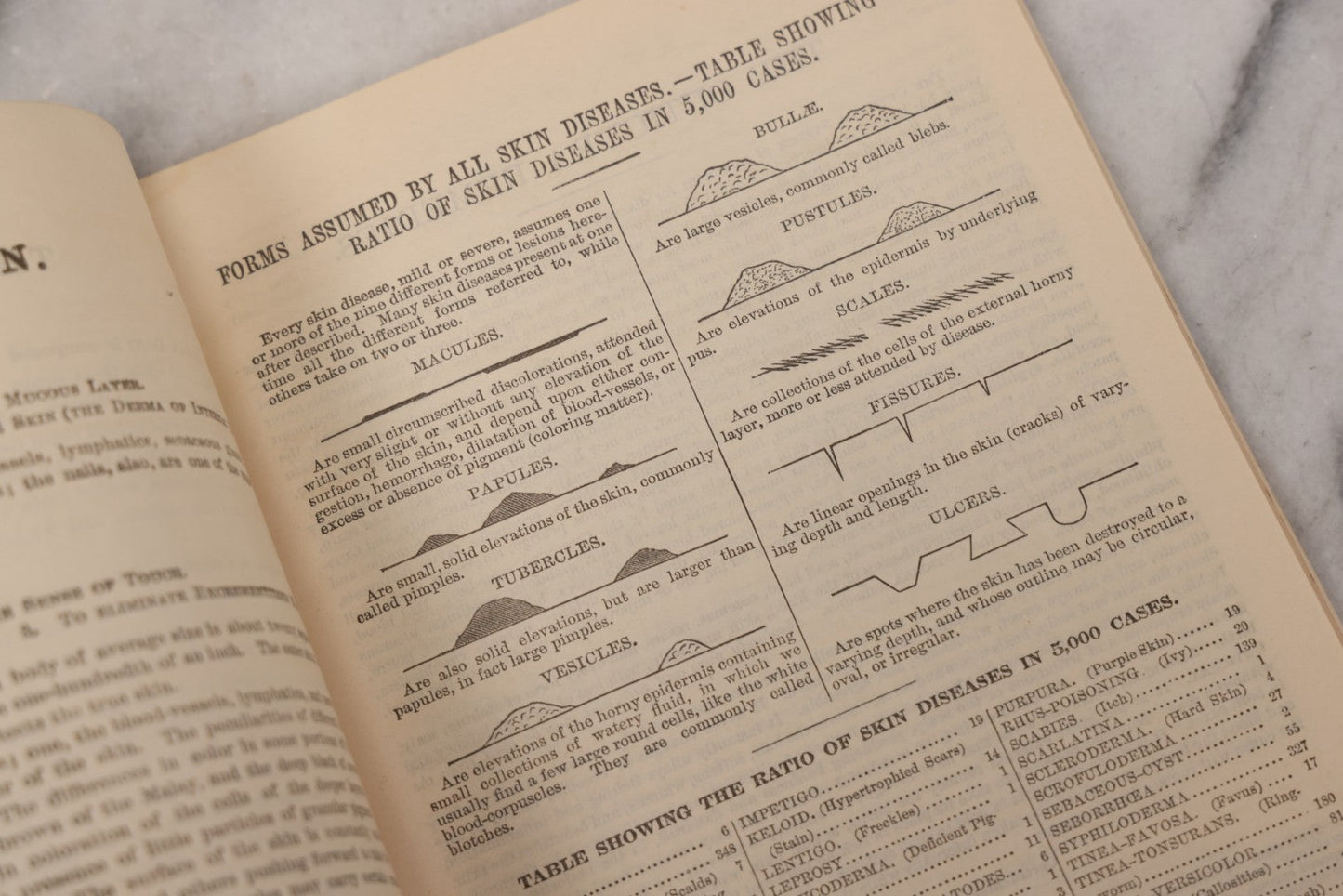 Lot 048 - "Diseases Of The Skin And Blood And How To Cure Them" Antique Illustrated Medical Booklet Prepared And Published By Potter Drug & Chemical Company, Boston, Massachusetts, 1885, Fourth Edition, With 37 Engravings "Drawn From Life"