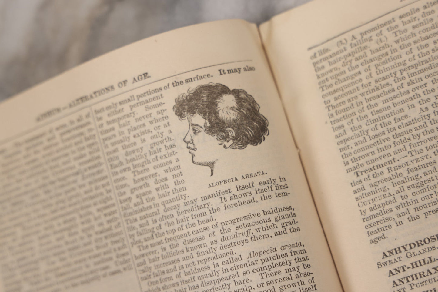 Lot 048 - "Diseases Of The Skin And Blood And How To Cure Them" Antique Illustrated Medical Booklet Prepared And Published By Potter Drug & Chemical Company, Boston, Massachusetts, 1885, Fourth Edition, With 37 Engravings "Drawn From Life"