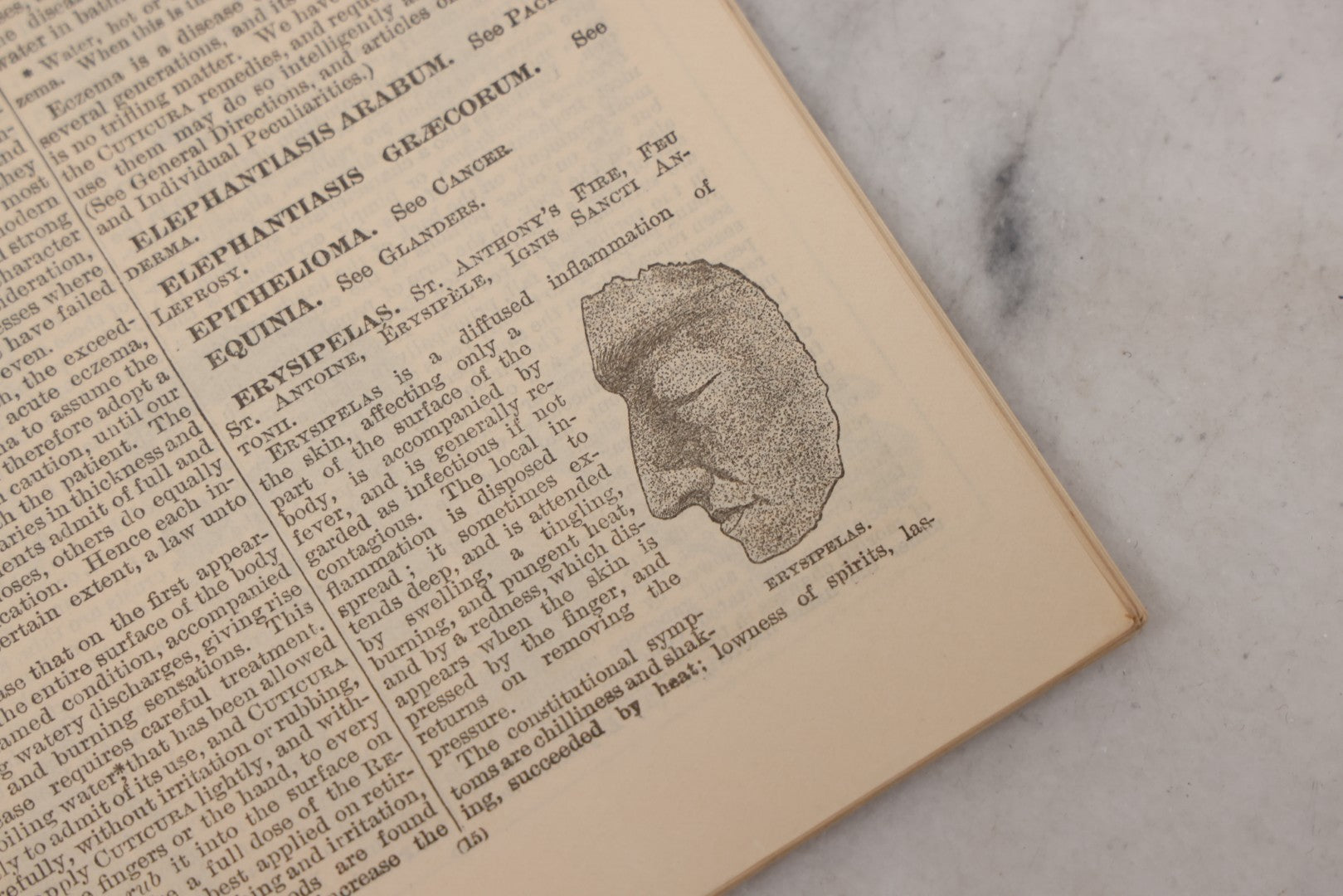 Lot 048 - "Diseases Of The Skin And Blood And How To Cure Them" Antique Illustrated Medical Booklet Prepared And Published By Potter Drug & Chemical Company, Boston, Massachusetts, 1885, Fourth Edition, With 37 Engravings "Drawn From Life"