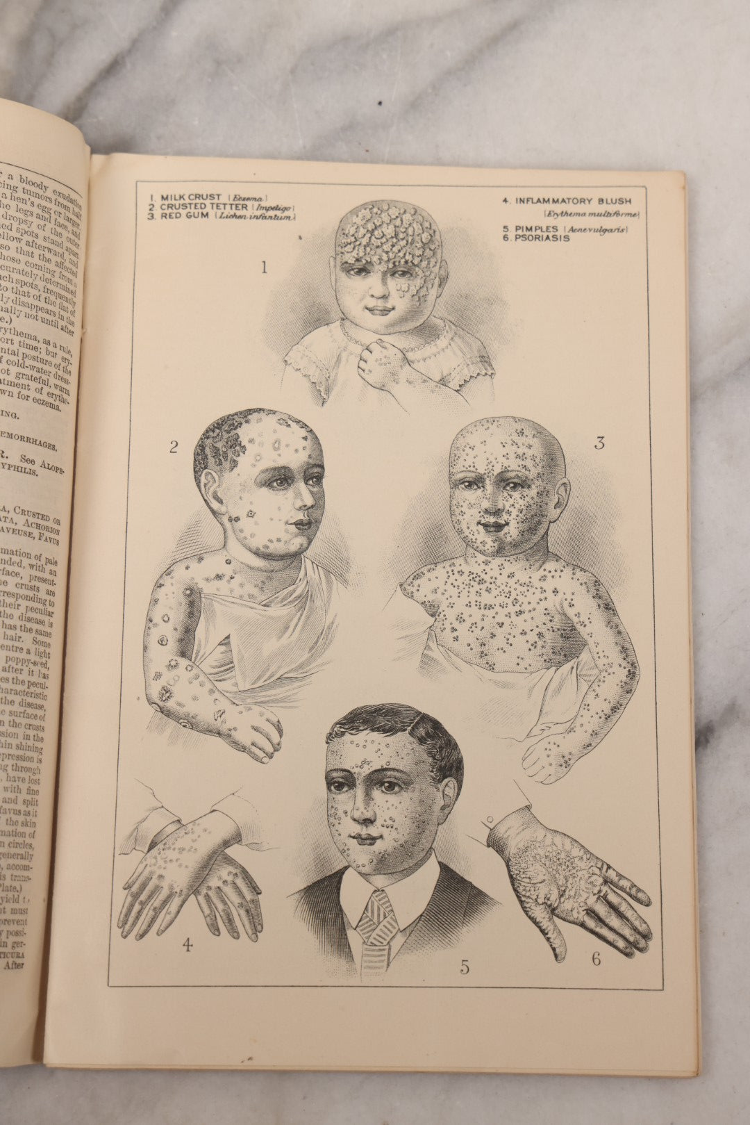 Lot 048 - "Diseases Of The Skin And Blood And How To Cure Them" Antique Illustrated Medical Booklet Prepared And Published By Potter Drug & Chemical Company, Boston, Massachusetts, 1885, Fourth Edition, With 37 Engravings "Drawn From Life"