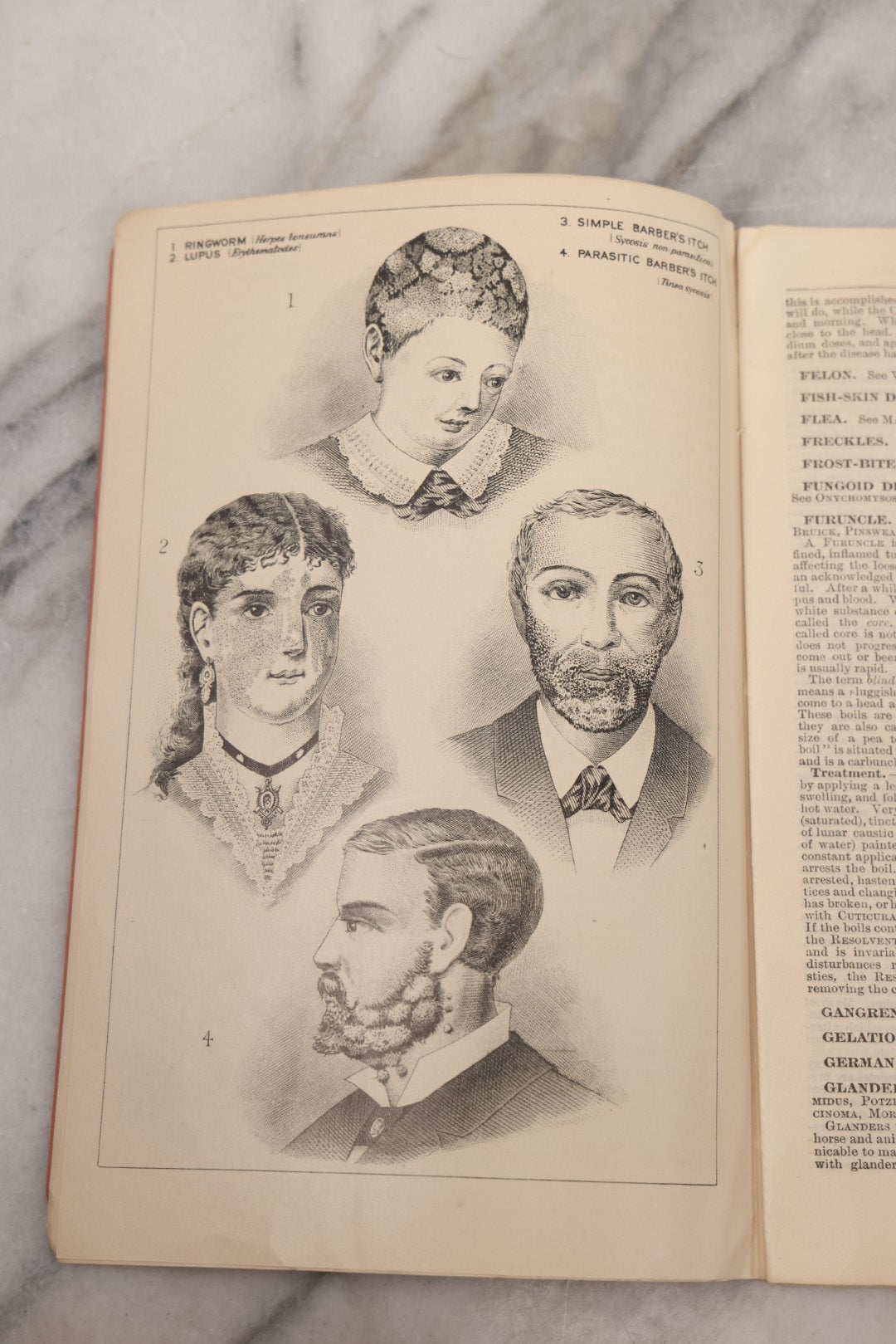 Lot 048 - "Diseases Of The Skin And Blood And How To Cure Them" Antique Illustrated Medical Booklet Prepared And Published By Potter Drug & Chemical Company, Boston, Massachusetts, 1885, Fourth Edition, With 37 Engravings "Drawn From Life"