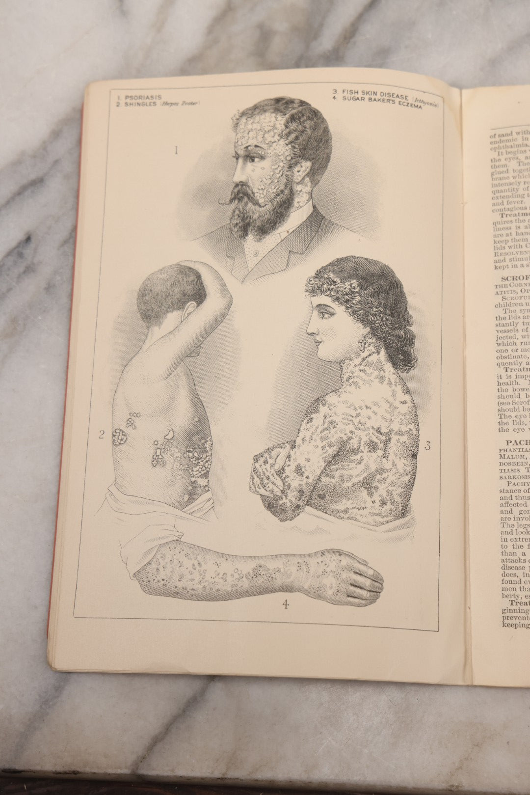 Lot 048 - "Diseases Of The Skin And Blood And How To Cure Them" Antique Illustrated Medical Booklet Prepared And Published By Potter Drug & Chemical Company, Boston, Massachusetts, 1885, Fourth Edition, With 37 Engravings "Drawn From Life"