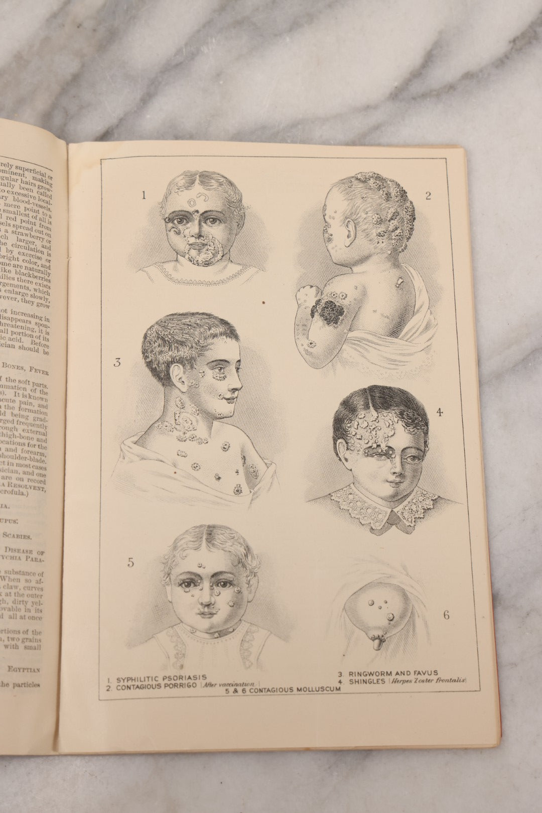 Lot 048 - "Diseases Of The Skin And Blood And How To Cure Them" Antique Illustrated Medical Booklet Prepared And Published By Potter Drug & Chemical Company, Boston, Massachusetts, 1885, Fourth Edition, With 37 Engravings "Drawn From Life"