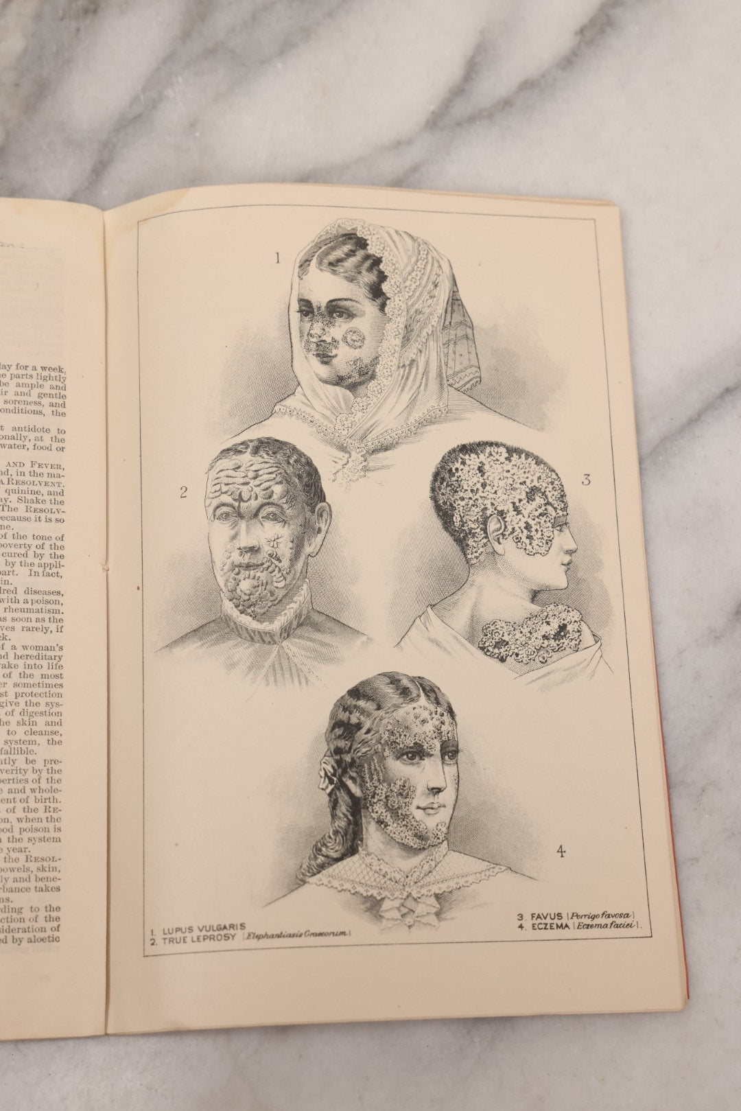 Lot 048 - "Diseases Of The Skin And Blood And How To Cure Them" Antique Illustrated Medical Booklet Prepared And Published By Potter Drug & Chemical Company, Boston, Massachusetts, 1885, Fourth Edition, With 37 Engravings "Drawn From Life"