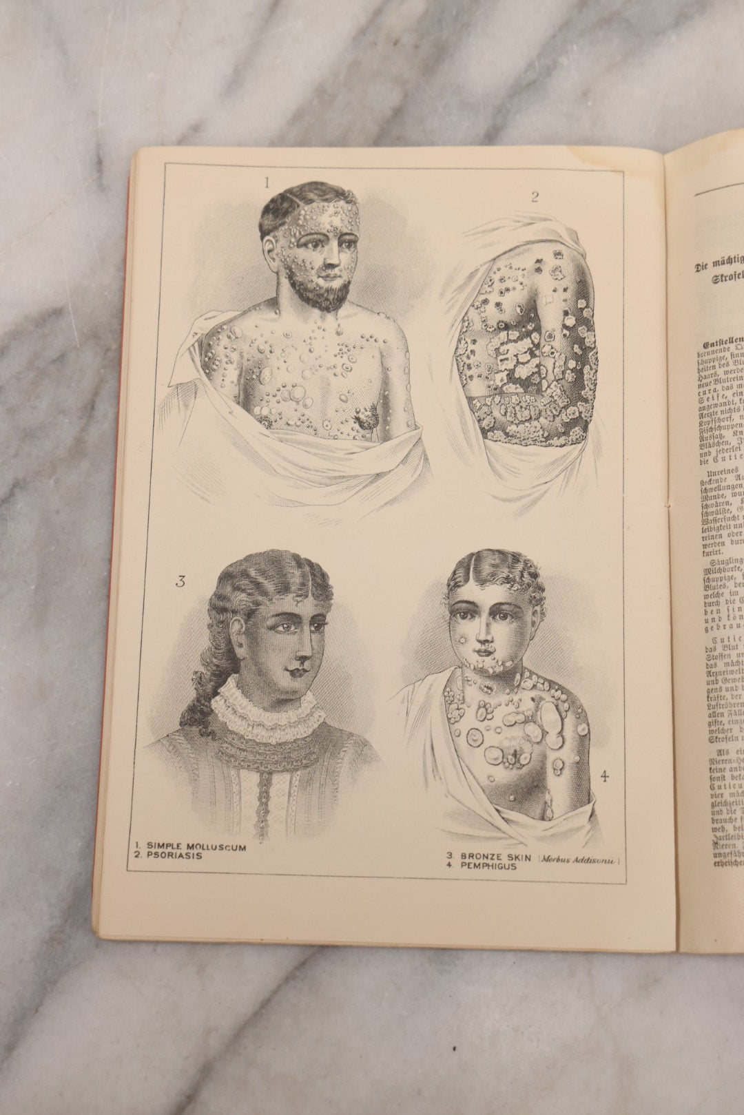 Lot 048 - "Diseases Of The Skin And Blood And How To Cure Them" Antique Illustrated Medical Booklet Prepared And Published By Potter Drug & Chemical Company, Boston, Massachusetts, 1885, Fourth Edition, With 37 Engravings "Drawn From Life"