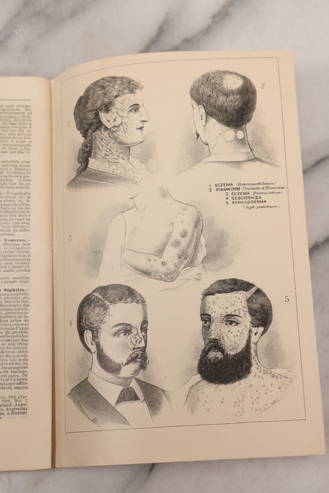 Lot 048 - "Diseases Of The Skin And Blood And How To Cure Them" Antique Illustrated Medical Booklet Prepared And Published By Potter Drug & Chemical Company, Boston, Massachusetts, 1885, Fourth Edition, With 37 Engravings "Drawn From Life"