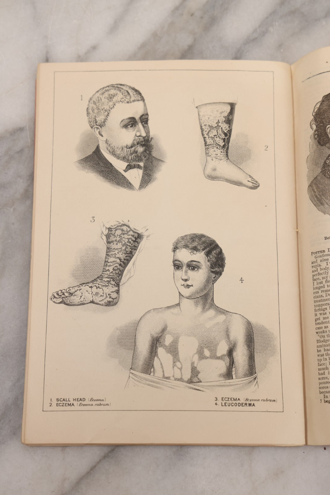 Lot 048 - "Diseases Of The Skin And Blood And How To Cure Them" Antique Illustrated Medical Booklet Prepared And Published By Potter Drug & Chemical Company, Boston, Massachusetts, 1885, Fourth Edition, With 37 Engravings "Drawn From Life"