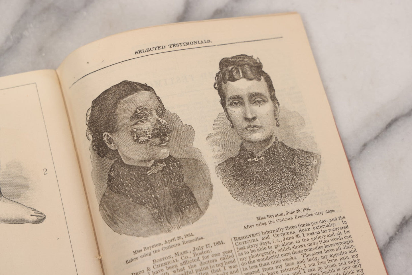 Lot 048 - "Diseases Of The Skin And Blood And How To Cure Them" Antique Illustrated Medical Booklet Prepared And Published By Potter Drug & Chemical Company, Boston, Massachusetts, 1885, Fourth Edition, With 37 Engravings "Drawn From Life"