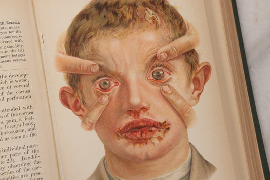 Lot 049 - "Atlas Of The External Diseases Of The Eye Including [...] Pathology And Treatment" Antique Medical Book By Prof. Dr. O. Haab, Translated From German, Illustrated With 76 Plates & 6 Engravings, Published By W.B. Saunders, Philadelphia, 1899