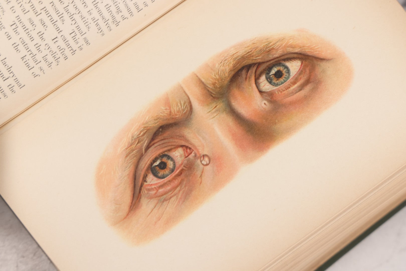 Lot 049 - "Atlas Of The External Diseases Of The Eye Including [...] Pathology And Treatment" Antique Medical Book By Prof. Dr. O. Haab, Translated From German, Illustrated With 76 Plates & 6 Engravings, Published By W.B. Saunders, Philadelphia, 1899