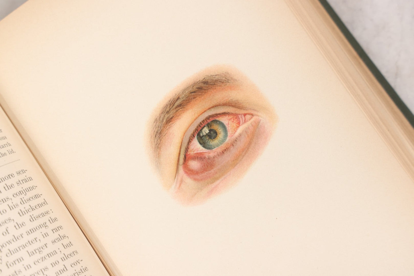 Lot 049 - "Atlas Of The External Diseases Of The Eye Including [...] Pathology And Treatment" Antique Medical Book By Prof. Dr. O. Haab, Translated From German, Illustrated With 76 Plates & 6 Engravings, Published By W.B. Saunders, Philadelphia, 1899