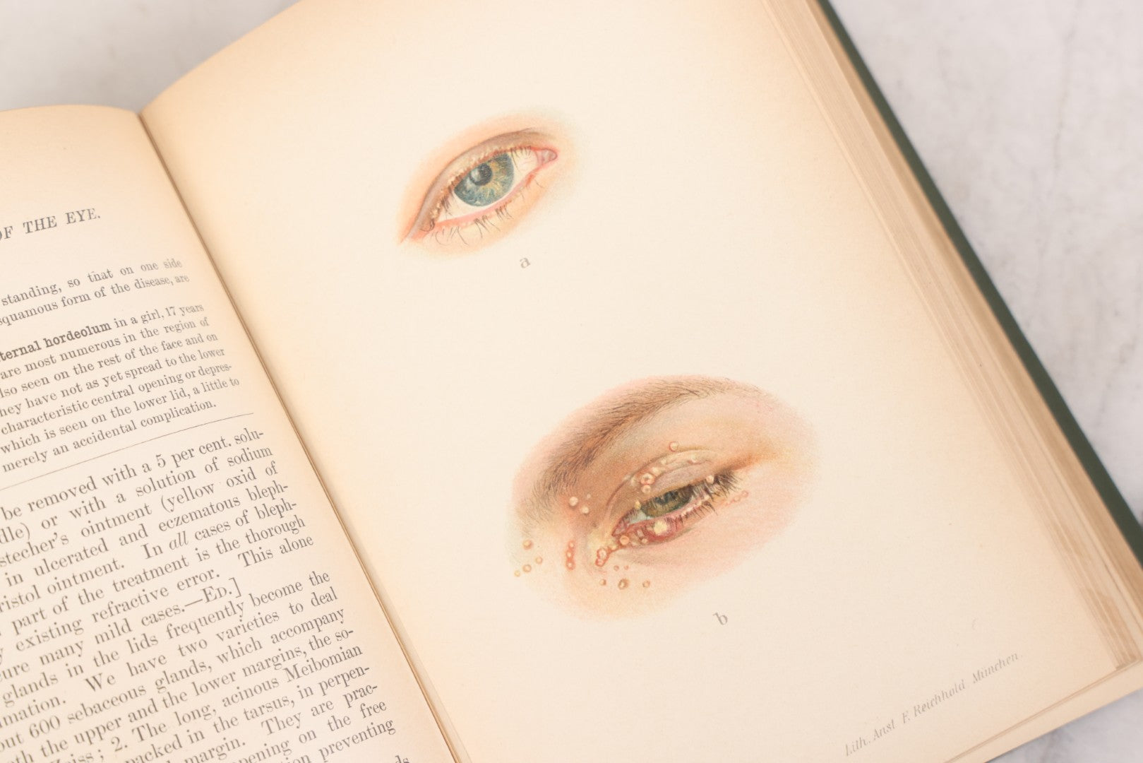 Lot 049 - "Atlas Of The External Diseases Of The Eye Including [...] Pathology And Treatment" Antique Medical Book By Prof. Dr. O. Haab, Translated From German, Illustrated With 76 Plates & 6 Engravings, Published By W.B. Saunders, Philadelphia, 1899