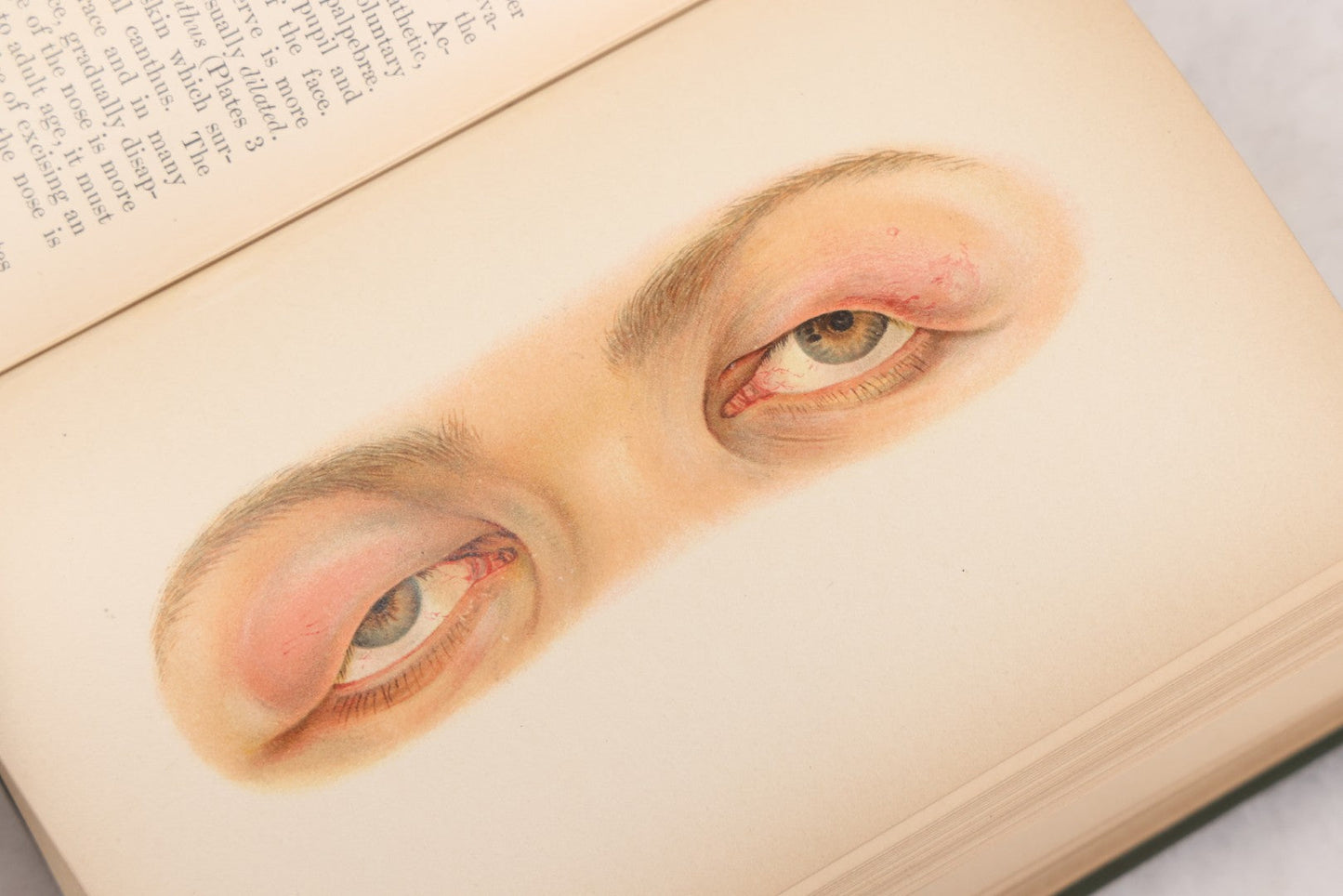 Lot 049 - "Atlas Of The External Diseases Of The Eye Including [...] Pathology And Treatment" Antique Medical Book By Prof. Dr. O. Haab, Translated From German, Illustrated With 76 Plates & 6 Engravings, Published By W.B. Saunders, Philadelphia, 1899