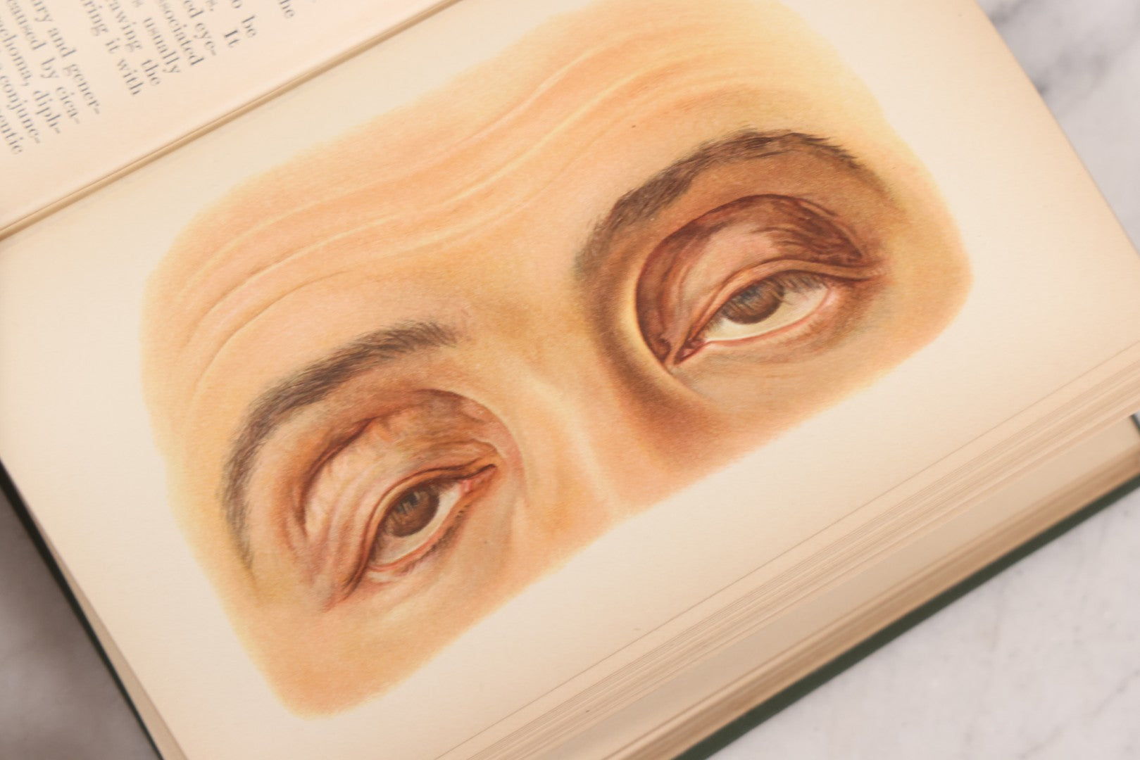 Lot 049 - "Atlas Of The External Diseases Of The Eye Including [...] Pathology And Treatment" Antique Medical Book By Prof. Dr. O. Haab, Translated From German, Illustrated With 76 Plates & 6 Engravings, Published By W.B. Saunders, Philadelphia, 1899