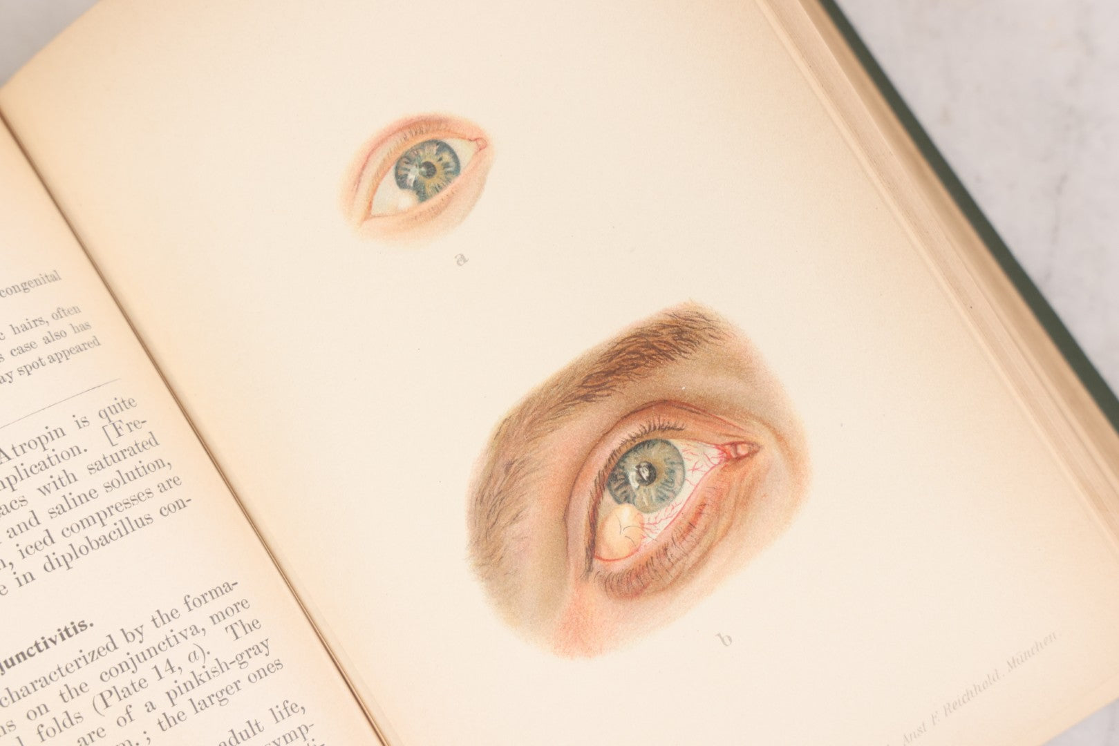 Lot 049 - "Atlas Of The External Diseases Of The Eye Including [...] Pathology And Treatment" Antique Medical Book By Prof. Dr. O. Haab, Translated From German, Illustrated With 76 Plates & 6 Engravings, Published By W.B. Saunders, Philadelphia, 1899