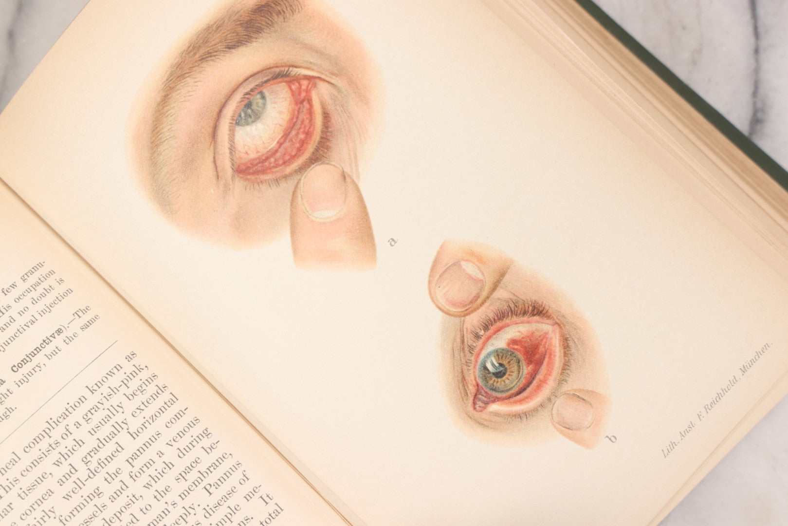 Lot 049 - "Atlas Of The External Diseases Of The Eye Including [...] Pathology And Treatment" Antique Medical Book By Prof. Dr. O. Haab, Translated From German, Illustrated With 76 Plates & 6 Engravings, Published By W.B. Saunders, Philadelphia, 1899