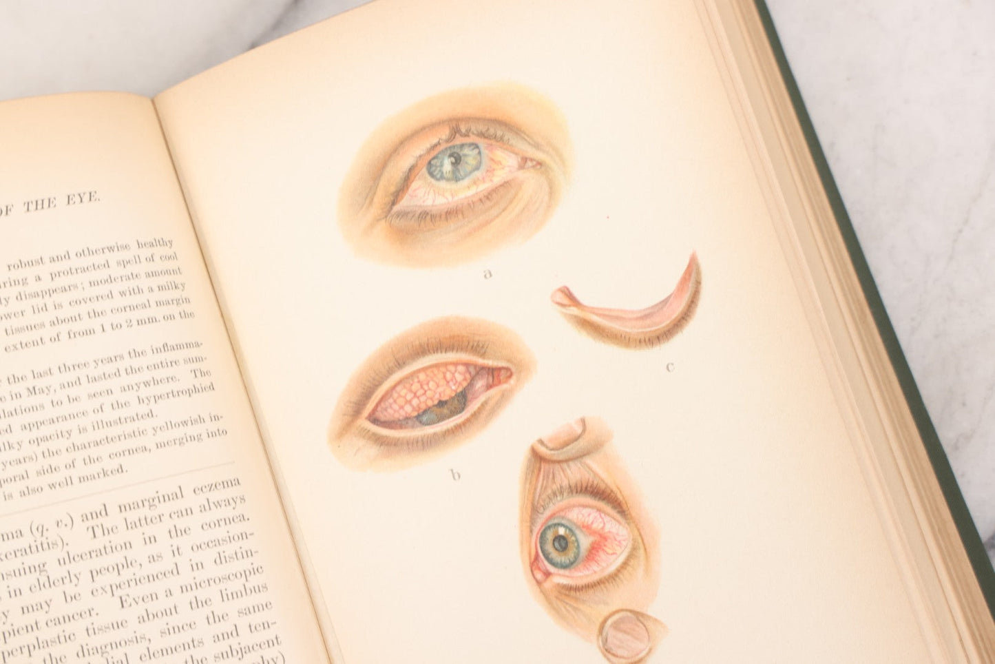 Lot 049 - "Atlas Of The External Diseases Of The Eye Including [...] Pathology And Treatment" Antique Medical Book By Prof. Dr. O. Haab, Translated From German, Illustrated With 76 Plates & 6 Engravings, Published By W.B. Saunders, Philadelphia, 1899