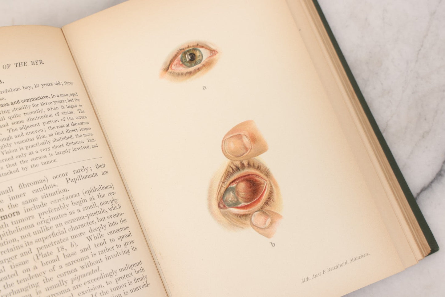 Lot 049 - "Atlas Of The External Diseases Of The Eye Including [...] Pathology And Treatment" Antique Medical Book By Prof. Dr. O. Haab, Translated From German, Illustrated With 76 Plates & 6 Engravings, Published By W.B. Saunders, Philadelphia, 1899