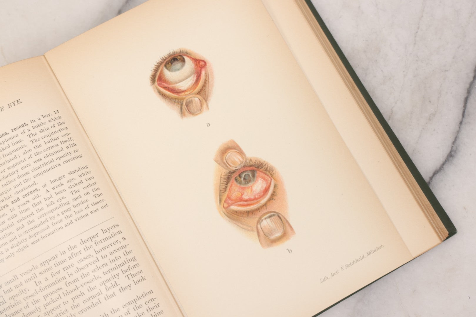 Lot 049 - "Atlas Of The External Diseases Of The Eye Including [...] Pathology And Treatment" Antique Medical Book By Prof. Dr. O. Haab, Translated From German, Illustrated With 76 Plates & 6 Engravings, Published By W.B. Saunders, Philadelphia, 1899