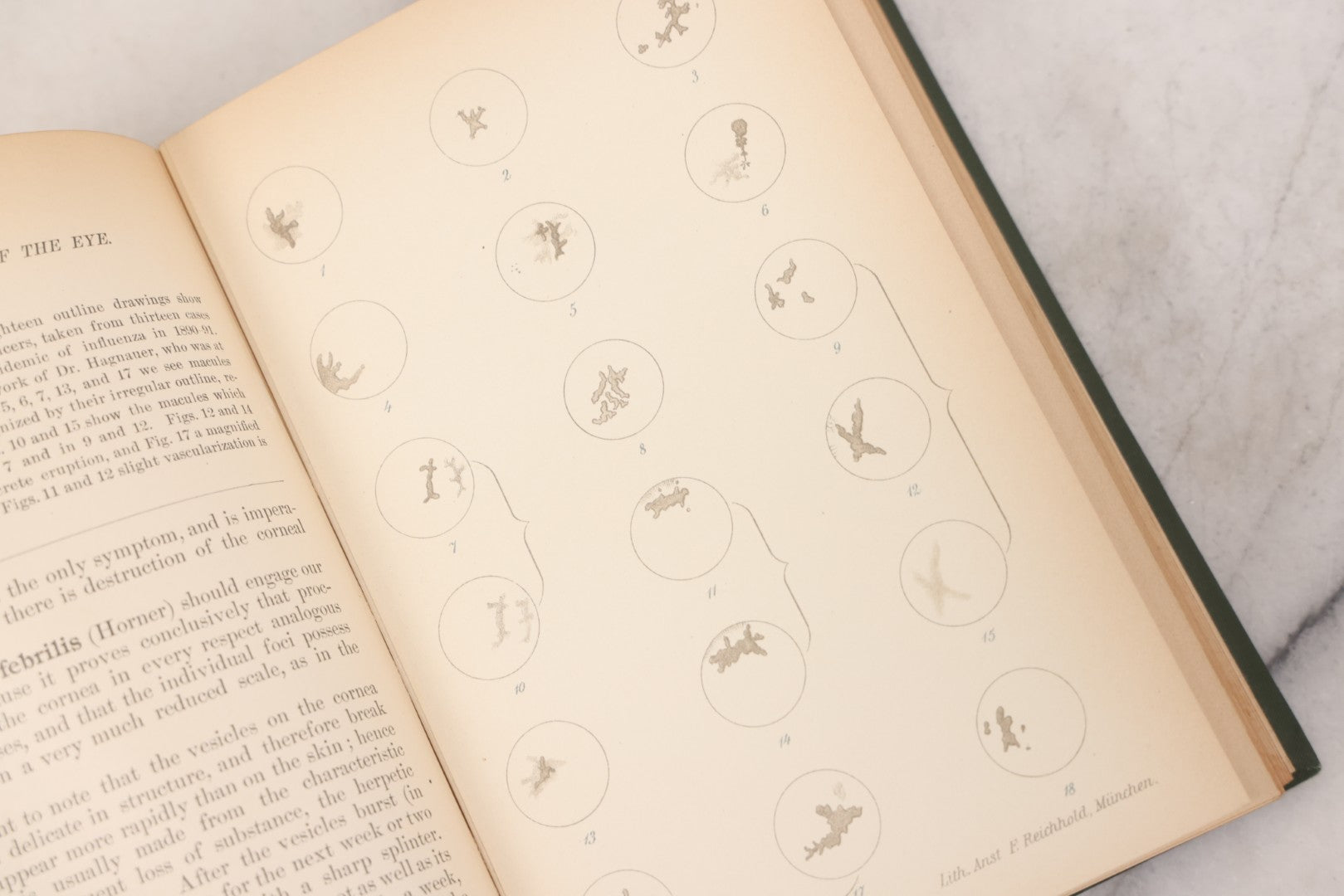 Lot 049 - "Atlas Of The External Diseases Of The Eye Including [...] Pathology And Treatment" Antique Medical Book By Prof. Dr. O. Haab, Translated From German, Illustrated With 76 Plates & 6 Engravings, Published By W.B. Saunders, Philadelphia, 1899