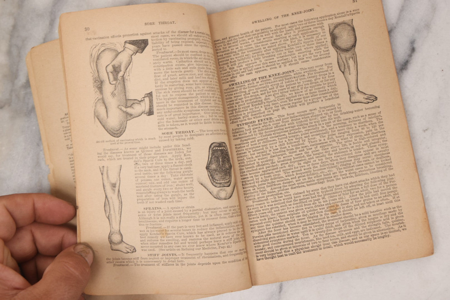 Lot 050 - "The Doctor At Home, Illustrated: Treating The Diseases Of Man And The Horse" Antique Illustrated Medical Booklet By Dr. B.J. Kendall Co., Enosburg Falls, Vermont, 1887