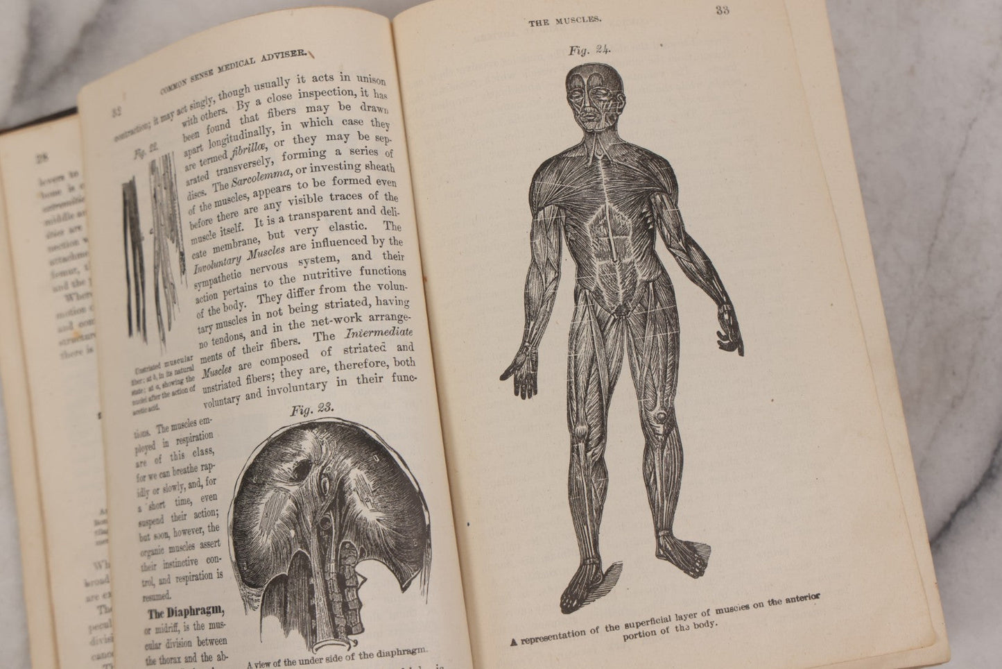Lot 051 - "The People's Common Sense Medical Adviser In Plain English, Or, Medicine Simplified" Antique Illustrated Medical Book By R.V. Pierce, M.D., Seventy-First Edition, Buffalo, New York, 1895