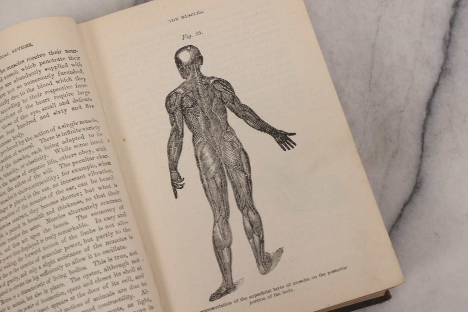 Lot 051 - "The People's Common Sense Medical Adviser In Plain English, Or, Medicine Simplified" Antique Illustrated Medical Book By R.V. Pierce, M.D., Seventy-First Edition, Buffalo, New York, 1895