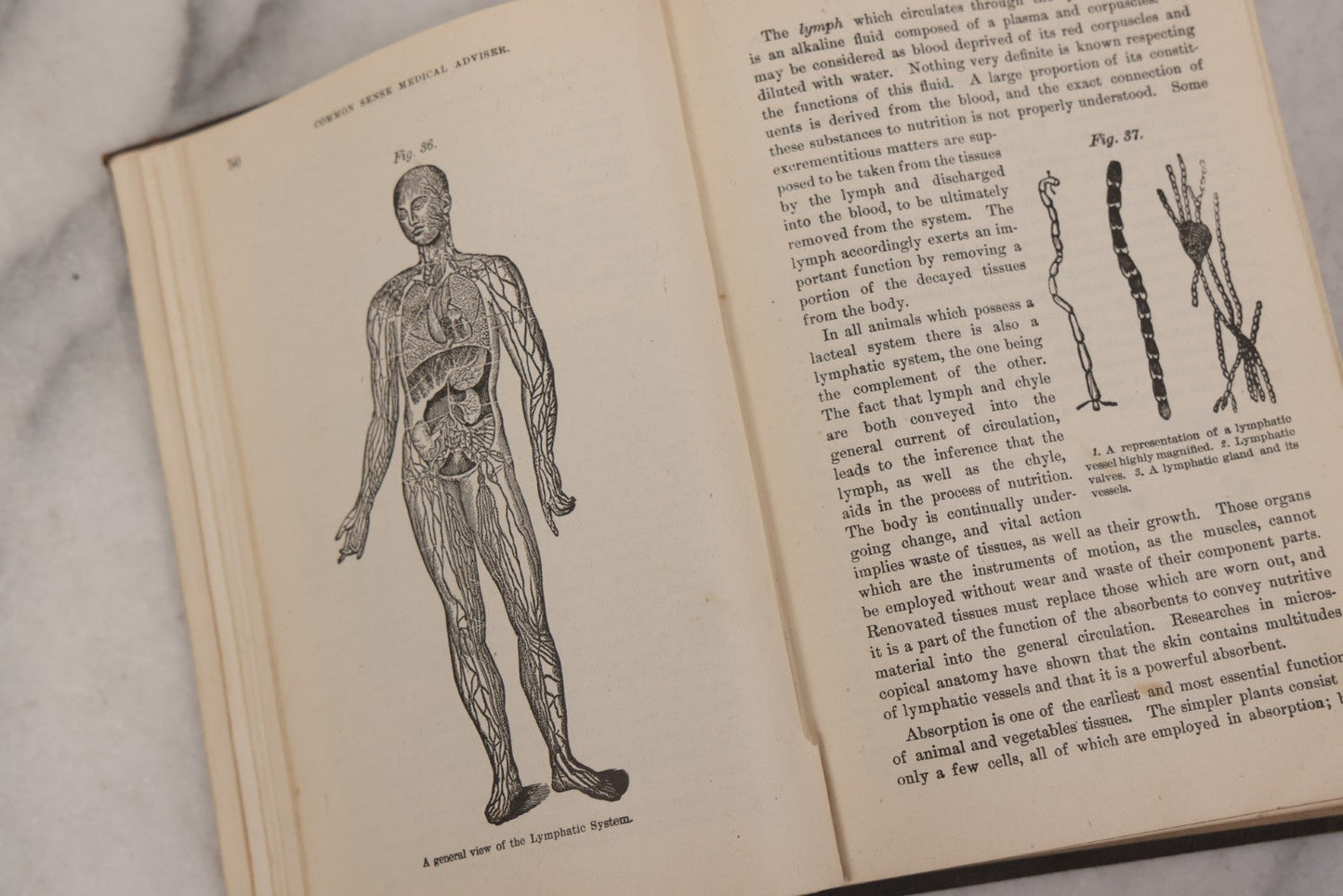 Lot 051 - "The People's Common Sense Medical Adviser In Plain English, Or, Medicine Simplified" Antique Illustrated Medical Book By R.V. Pierce, M.D., Seventy-First Edition, Buffalo, New York, 1895