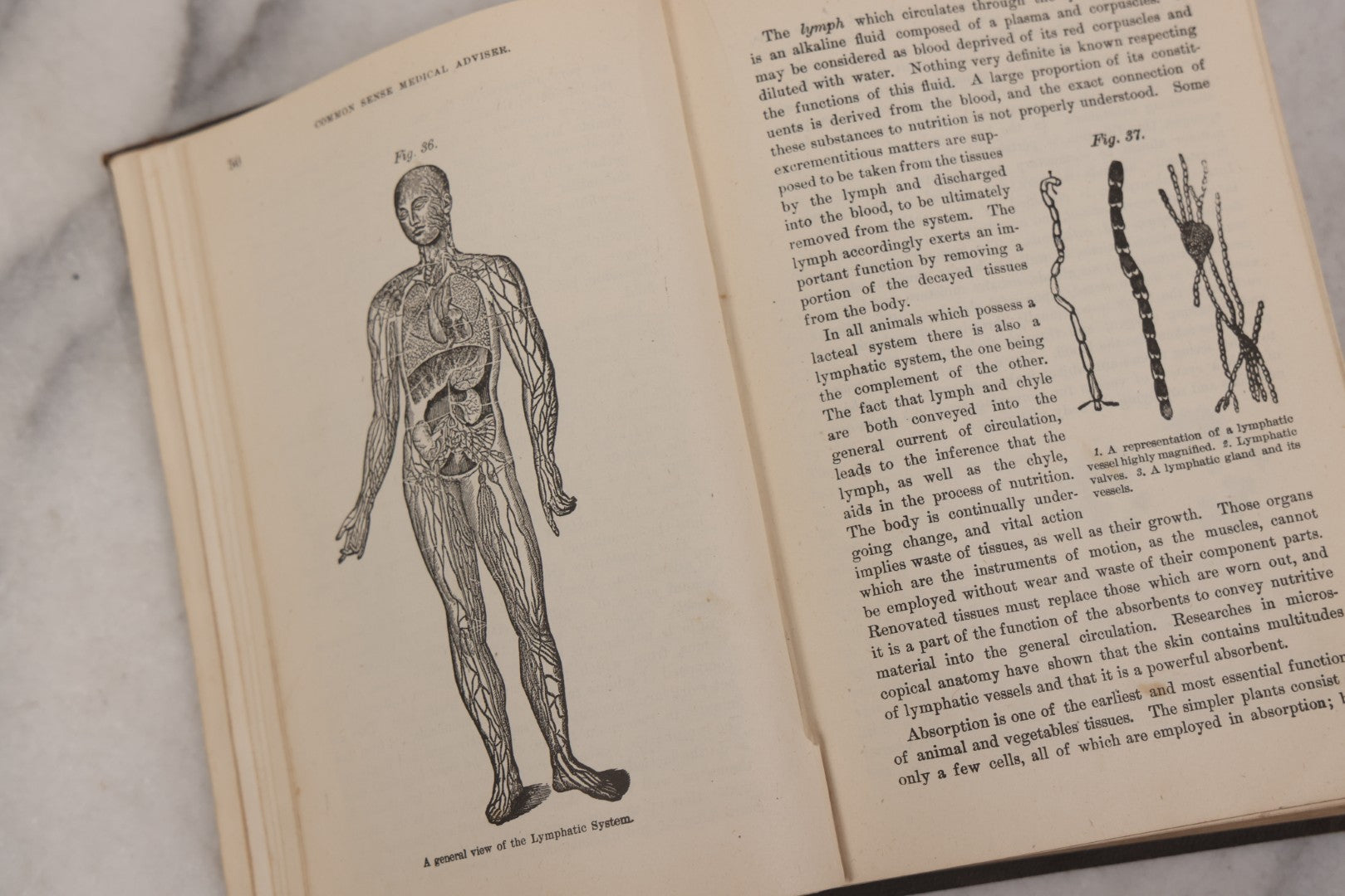 Lot 051 - "The People's Common Sense Medical Adviser In Plain English, Or, Medicine Simplified" Antique Illustrated Medical Book By R.V. Pierce, M.D., Seventy-First Edition, Buffalo, New York, 1895