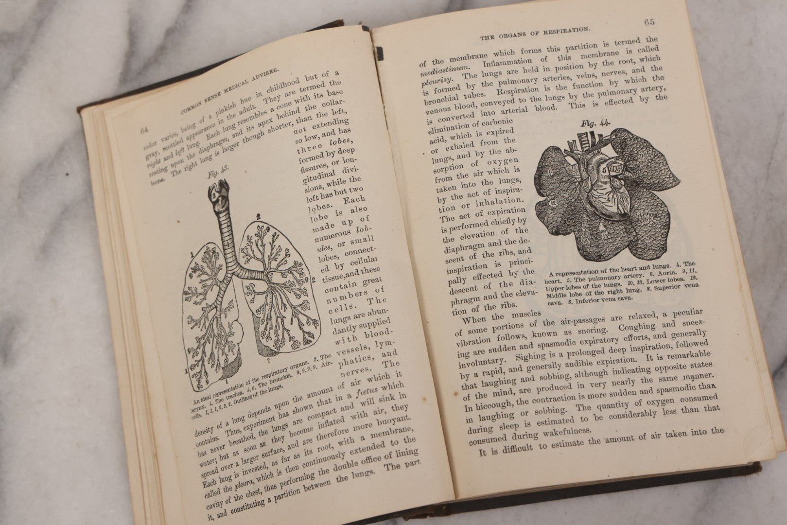 Lot 051 - "The People's Common Sense Medical Adviser In Plain English, Or, Medicine Simplified" Antique Illustrated Medical Book By R.V. Pierce, M.D., Seventy-First Edition, Buffalo, New York, 1895