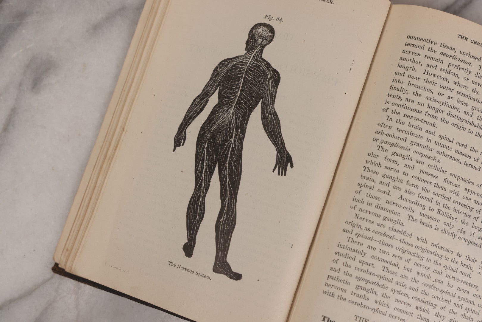 Lot 051 - "The People's Common Sense Medical Adviser In Plain English, Or, Medicine Simplified" Antique Illustrated Medical Book By R.V. Pierce, M.D., Seventy-First Edition, Buffalo, New York, 1895