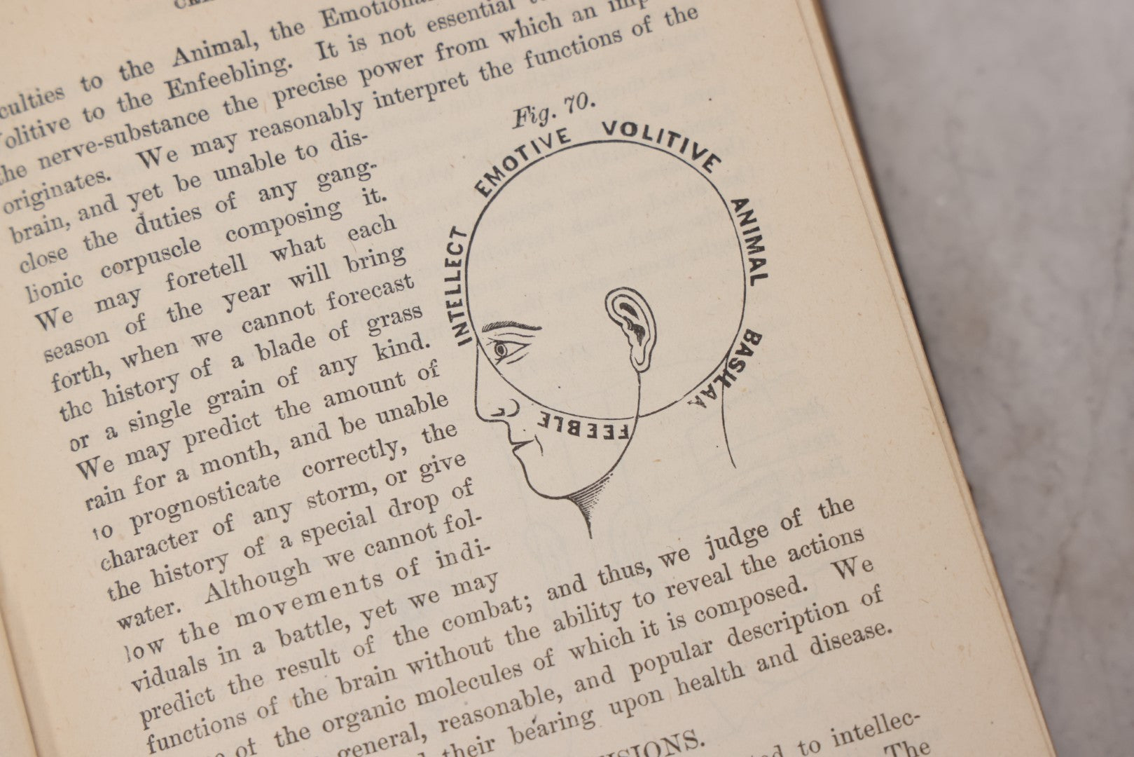 Lot 051 - "The People's Common Sense Medical Adviser In Plain English, Or, Medicine Simplified" Antique Illustrated Medical Book By R.V. Pierce, M.D., Seventy-First Edition, Buffalo, New York, 1895