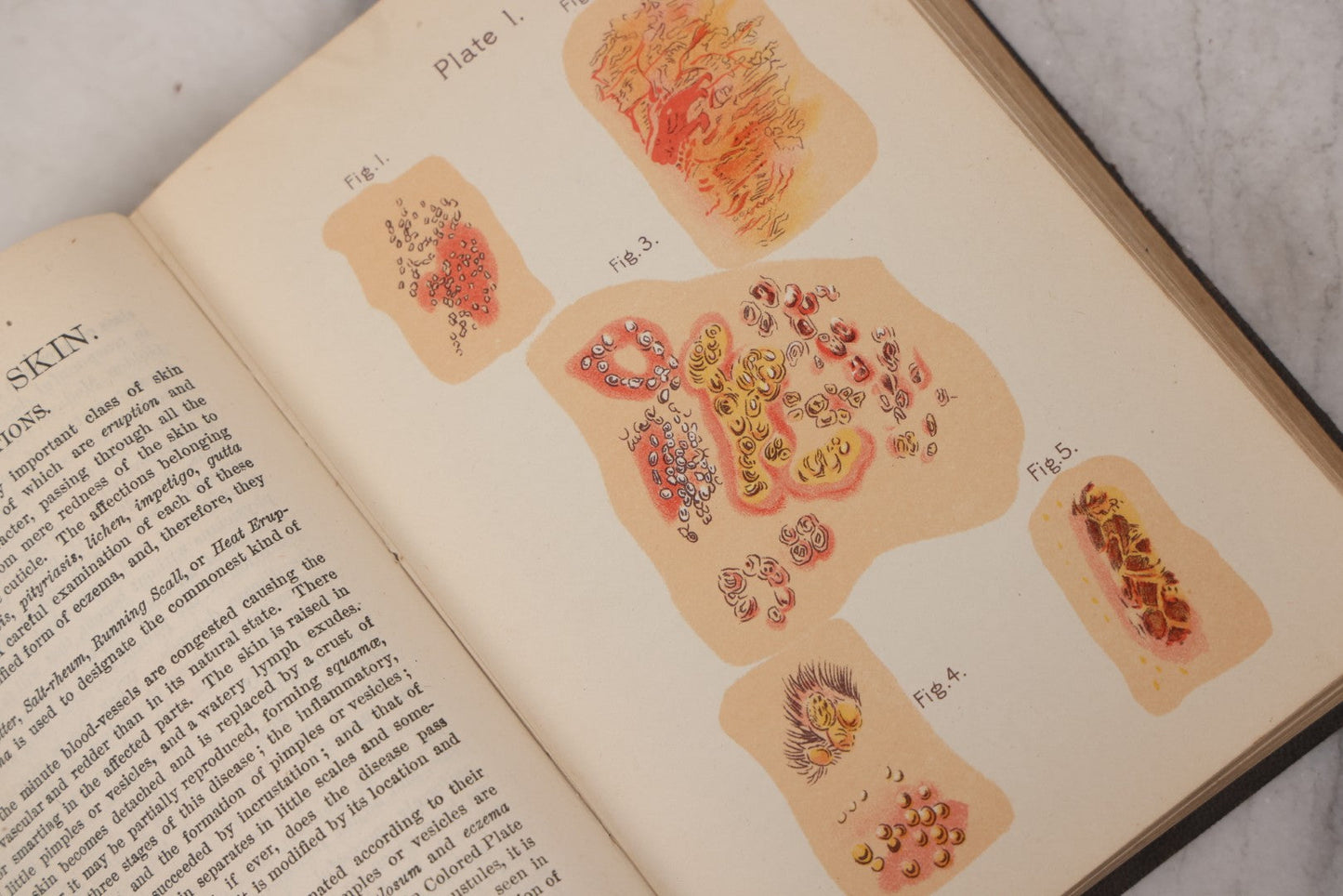 Lot 051 - "The People's Common Sense Medical Adviser In Plain English, Or, Medicine Simplified" Antique Illustrated Medical Book By R.V. Pierce, M.D., Seventy-First Edition, Buffalo, New York, 1895