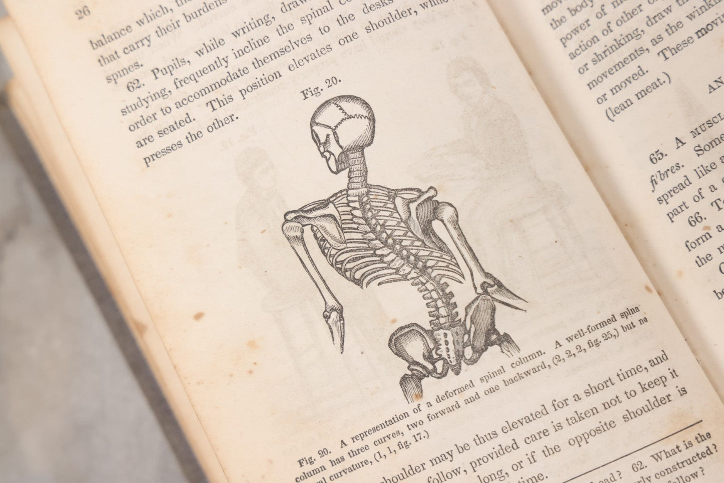 Lot 052 - "First Book On Anatomy, Physiology, And Hygiene, For Grammar Schools And Families" Antique Medical Book By Calvin Cutter, M.D. With 83 Engraved Illustrations, Stereotype Edition, Published By Benjamin B. Mussey & Co., Boston, 1850