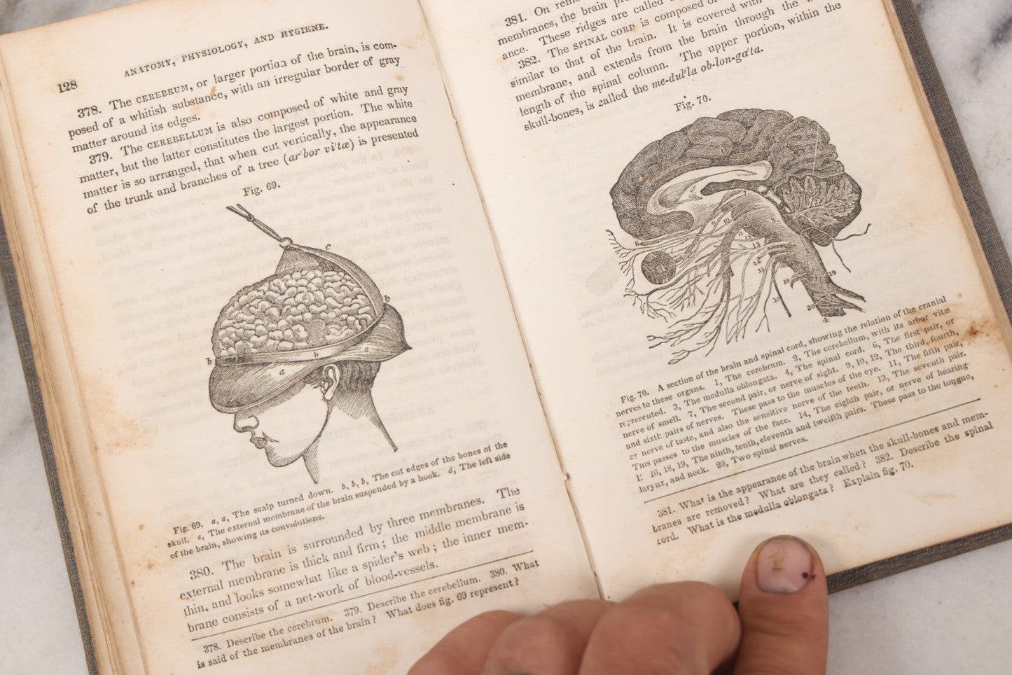 Lot 052 - "First Book On Anatomy, Physiology, And Hygiene, For Grammar Schools And Families" Antique Medical Book By Calvin Cutter, M.D. With 83 Engraved Illustrations, Stereotype Edition, Published By Benjamin B. Mussey & Co., Boston, 1850