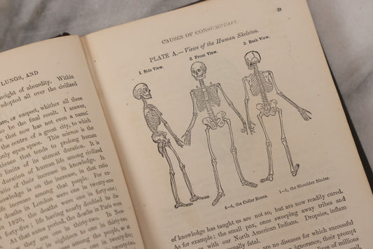Lot 053 - "Dr. Fitch's Lectures On Consumption: Six Lectures On The Functions Of The Lungs" Antique Medical Book By Samuel Sheldon Fitch, A.M., M.D., With 30 Illustrations, Published By S.S. Fitch & Co., New York, 1959