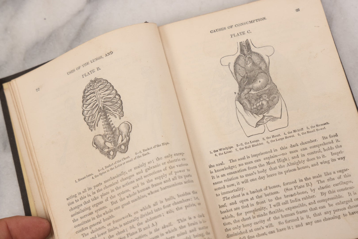 Lot 053 - "Dr. Fitch's Lectures On Consumption: Six Lectures On The Functions Of The Lungs" Antique Medical Book By Samuel Sheldon Fitch, A.M., M.D., With 30 Illustrations, Published By S.S. Fitch & Co., New York, 1959