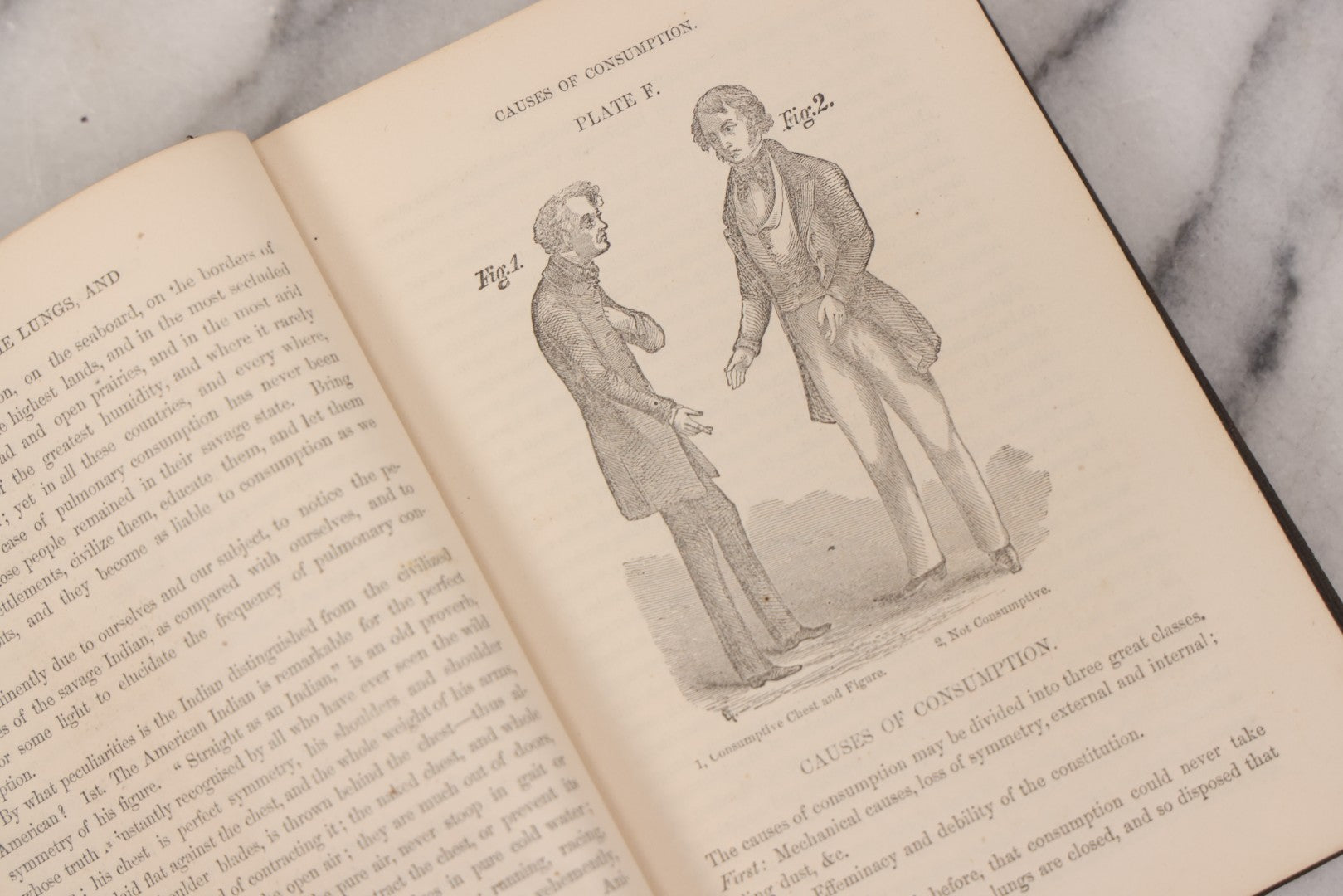 Lot 053 - "Dr. Fitch's Lectures On Consumption: Six Lectures On The Functions Of The Lungs" Antique Medical Book By Samuel Sheldon Fitch, A.M., M.D., With 30 Illustrations, Published By S.S. Fitch & Co., New York, 1959