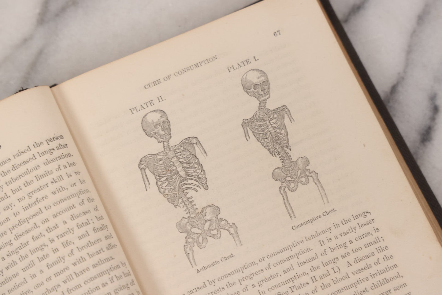 Lot 053 - "Dr. Fitch's Lectures On Consumption: Six Lectures On The Functions Of The Lungs" Antique Medical Book By Samuel Sheldon Fitch, A.M., M.D., With 30 Illustrations, Published By S.S. Fitch & Co., New York, 1959