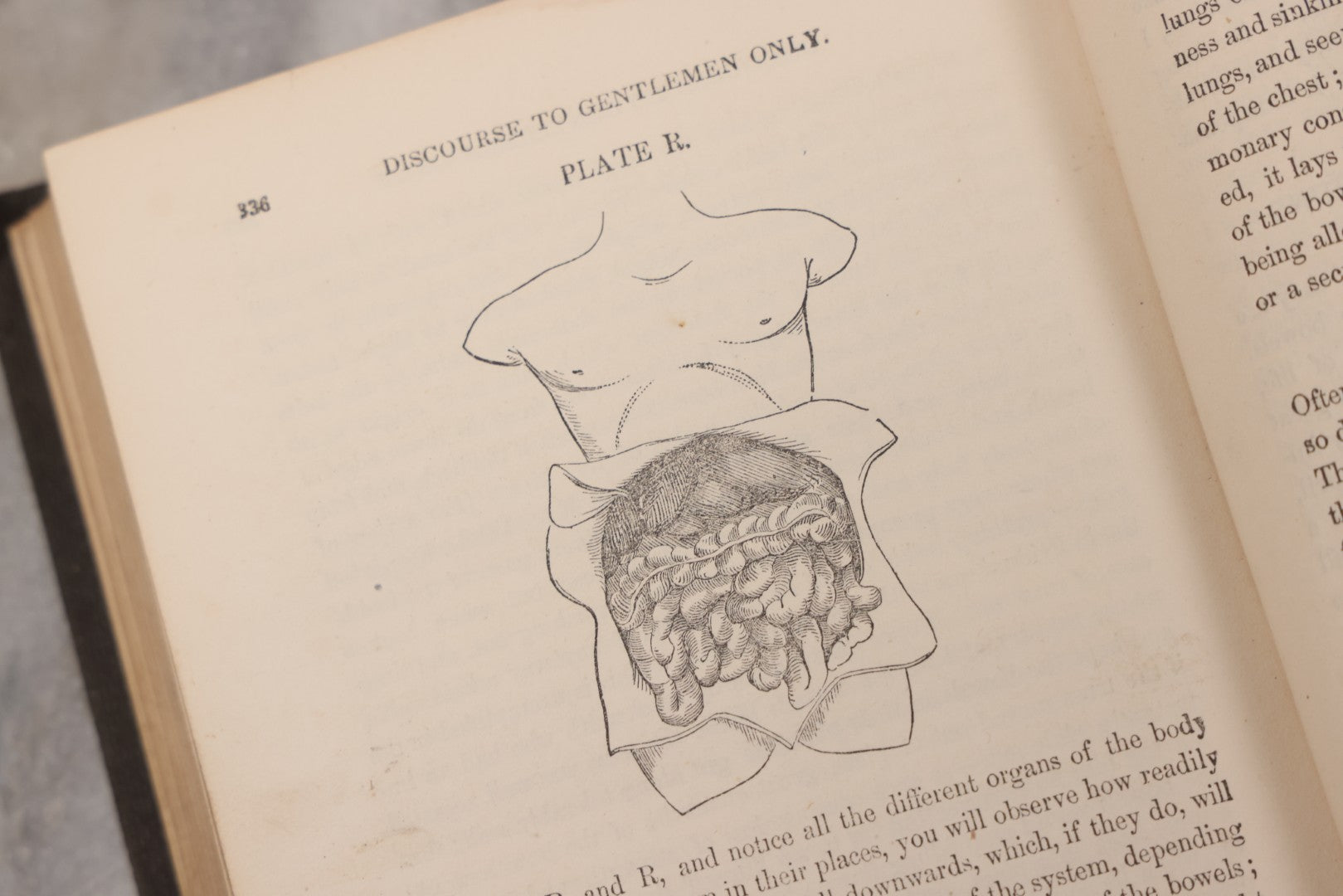 Lot 053 - "Dr. Fitch's Lectures On Consumption: Six Lectures On The Functions Of The Lungs" Antique Medical Book By Samuel Sheldon Fitch, A.M., M.D., With 30 Illustrations, Published By S.S. Fitch & Co., New York, 1959