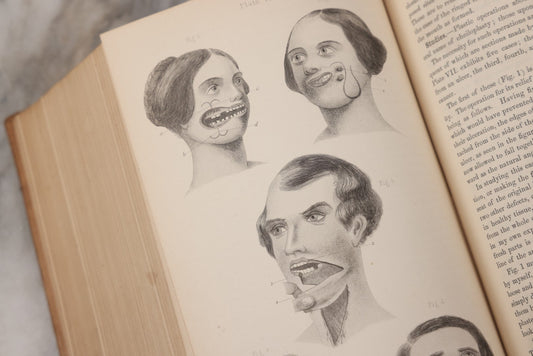 Lot 055 - "A System Of Oral Surgery: Diseases And Surgery Of The Mouth, Jaws, And Associated Parts" Antique Book By James E. Garretson, M.D., Illustrated With Steel Plates And Wood Cuts, 3rd Edition, Published By J.B. Lippincott & Co., Philadelphia, 1881