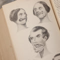 Lot 055 - "A System Of Oral Surgery: Diseases And Surgery Of The Mouth, Jaws, And Associated Parts" Antique Book By James E. Garretson, M.D., Illustrated With Steel Plates And Wood Cuts, 3rd Edition, Published By J.B. Lippincott & Co., Philadelphia, 1881