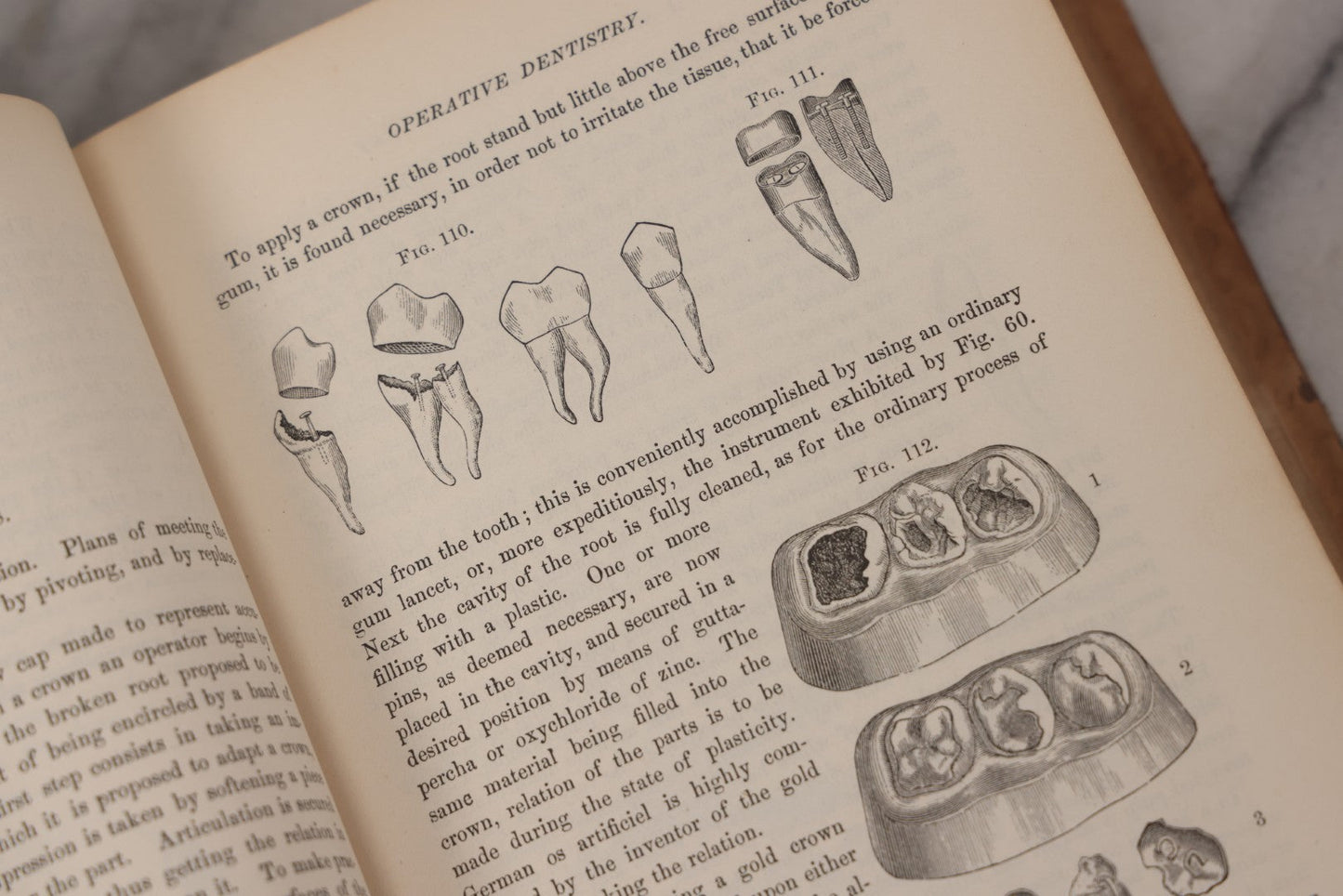 Lot 055 - "A System Of Oral Surgery: Diseases And Surgery Of The Mouth, Jaws, And Associated Parts" Antique Book By James E. Garretson, M.D., Illustrated With Steel Plates And Wood Cuts, 3rd Edition, Published By J.B. Lippincott & Co., Philadelphia, 1881