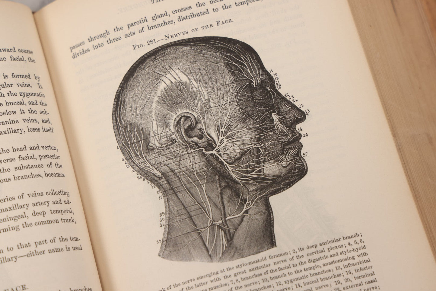 Lot 055 - "A System Of Oral Surgery: Diseases And Surgery Of The Mouth, Jaws, And Associated Parts" Antique Book By James E. Garretson, M.D., Illustrated With Steel Plates And Wood Cuts, 3rd Edition, Published By J.B. Lippincott & Co., Philadelphia, 1881