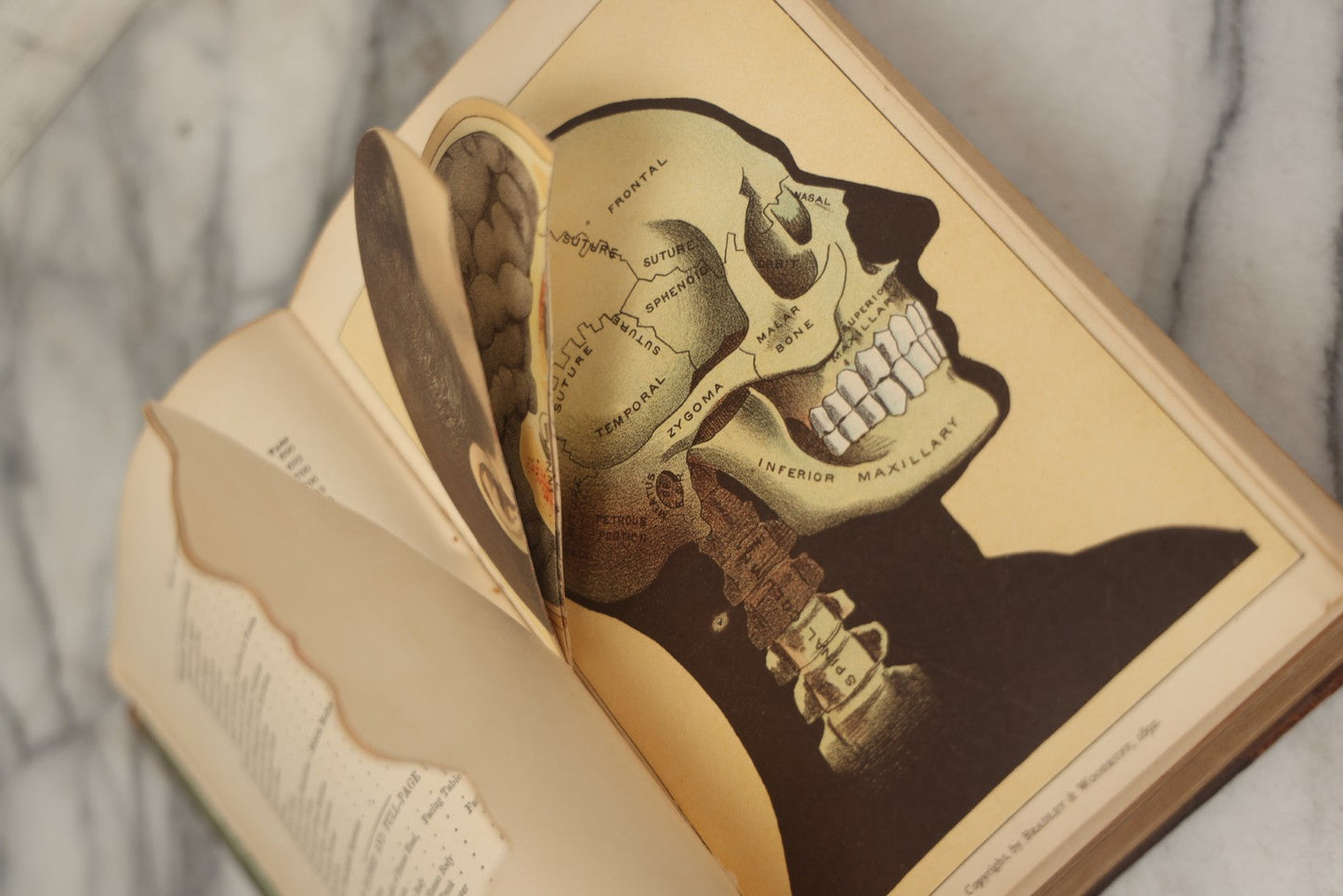 Lot 062 - "New Warren's Household Physician" Illustrated Antique Medical Reference Book With Layered Sectional Manikin Anatomical Illustrations, Debossed Woman's Bust On Cover, Other Full Color Plates, Published By A.I. Bradley & Company, Boston, 1904
