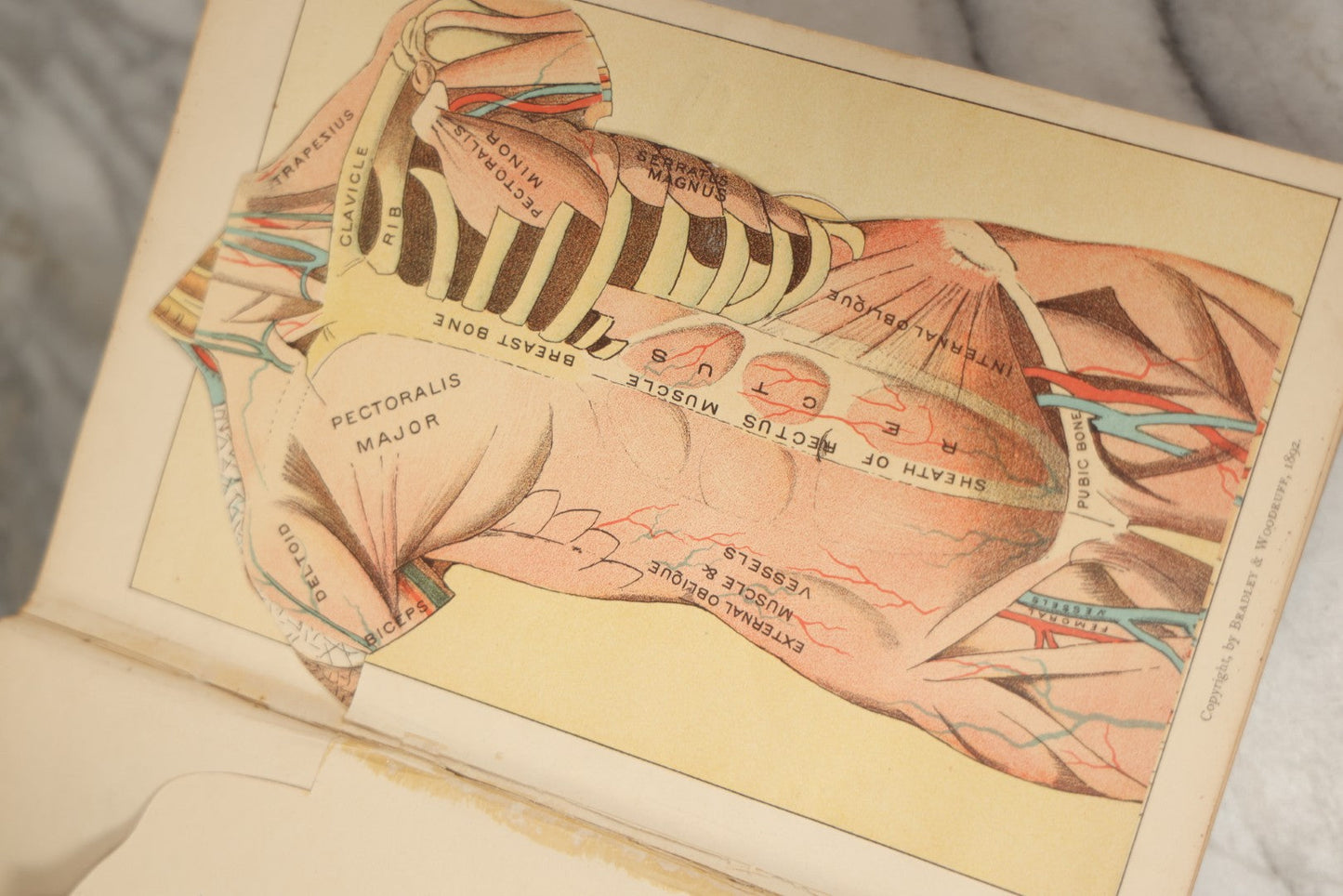 Lot 062 - "New Warren's Household Physician" Illustrated Antique Medical Reference Book With Layered Sectional Manikin Anatomical Illustrations, Debossed Woman's Bust On Cover, Other Full Color Plates, Published By A.I. Bradley & Company, Boston, 1904